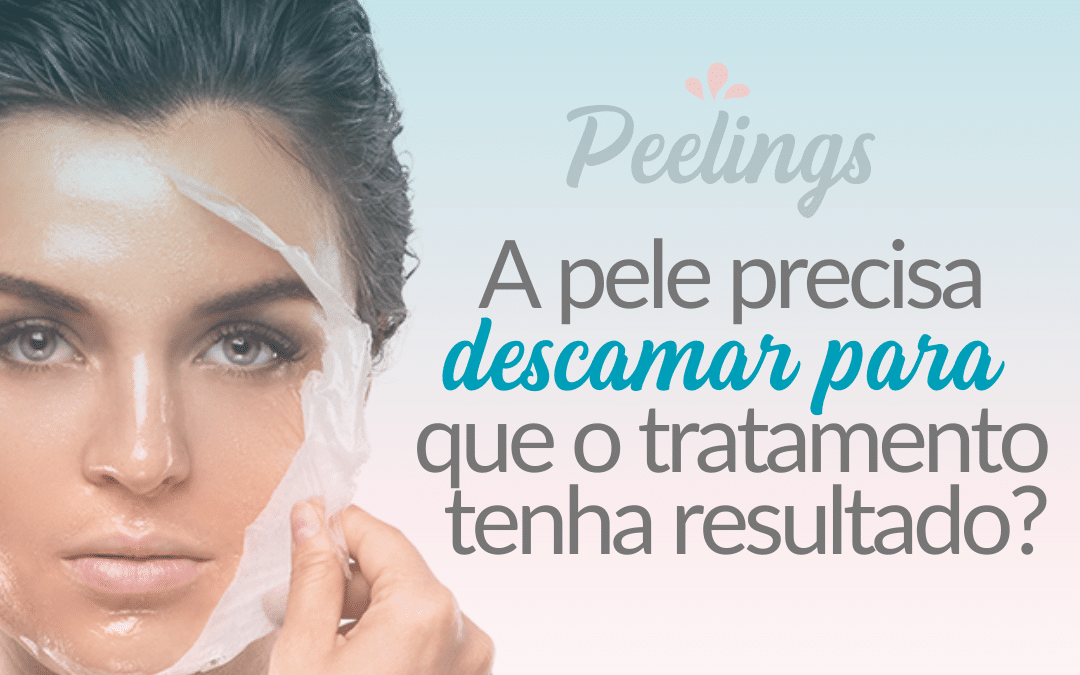 Peelings – a pele precisa descamar para que o tratamento tenha resultado?